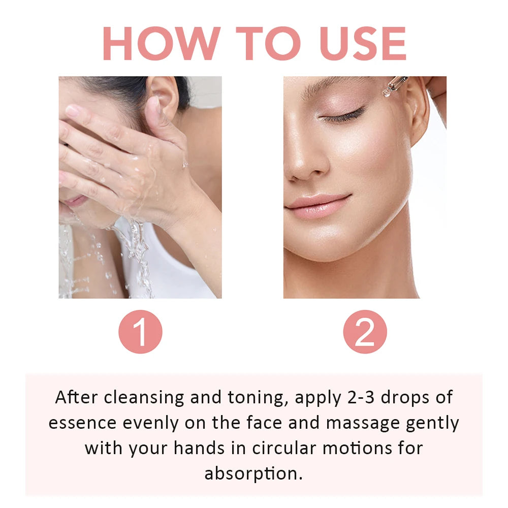 Niacinamide Face Serum – Dark Spot & Pore Corrector (30ml)